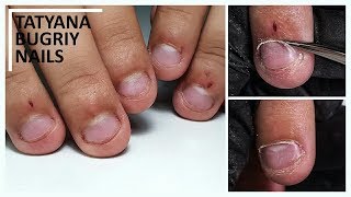 HUGE Transformation On Bitten Nails | Dual Forms |Russian Manicure, E-File Manicure