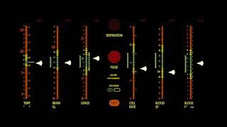 Sickbay medical monitor animation