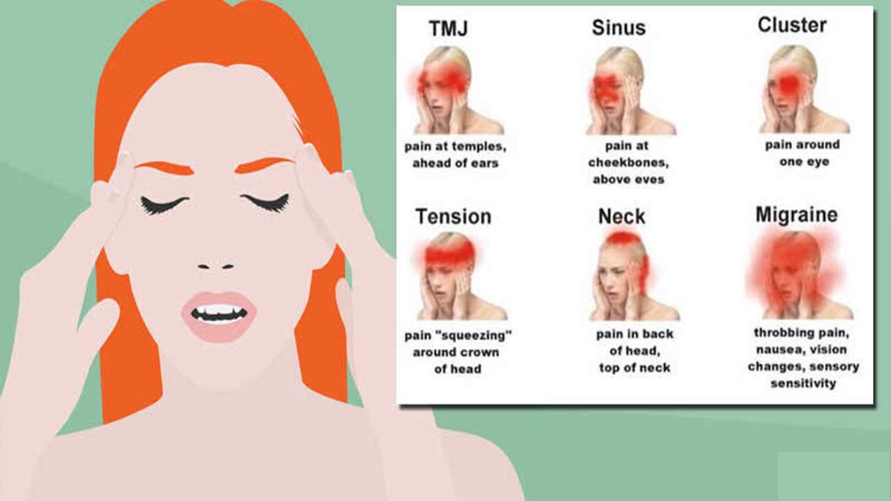 Headache Types Chart