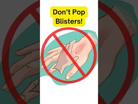 First aid for