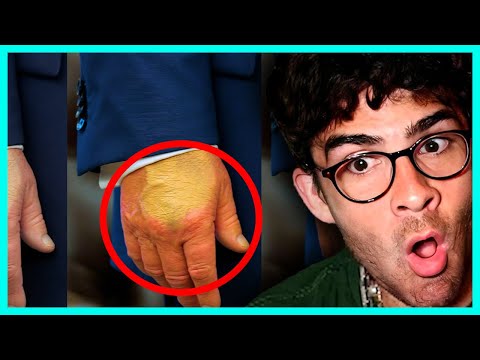 Thumbnail for IS TRUMP DYING??? | HasanAbi Reacts
