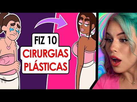 SHE HAD 10 PLASTIC SURGERIES ( it went VERY WRONG !!? )