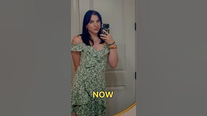 Chris Tyson THEN And NOW😱@MrBeast #mrbeastshorts#shorts