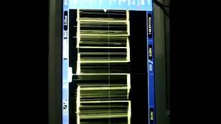 VID 20180225 0059341