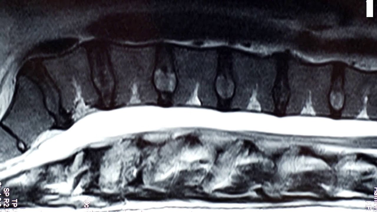 Next Generation Imaging Upright MRI in Nashville Tennessee YouTube