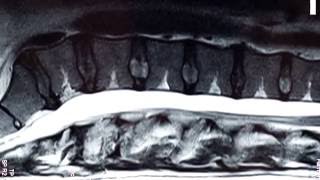 Next Generation Imaging   Upright MRI in Nashville Tennessee