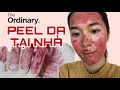 Peel da tại nhà với The Ordinary Peeling Solution | 15 lưu ý khi sử dụng tẩy da chết hoá học