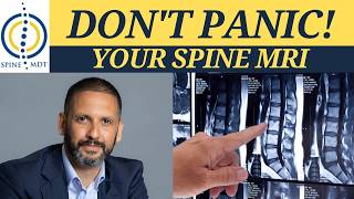 The 5 MRI Findings That Scare Patients Most But Usually Shouldn't