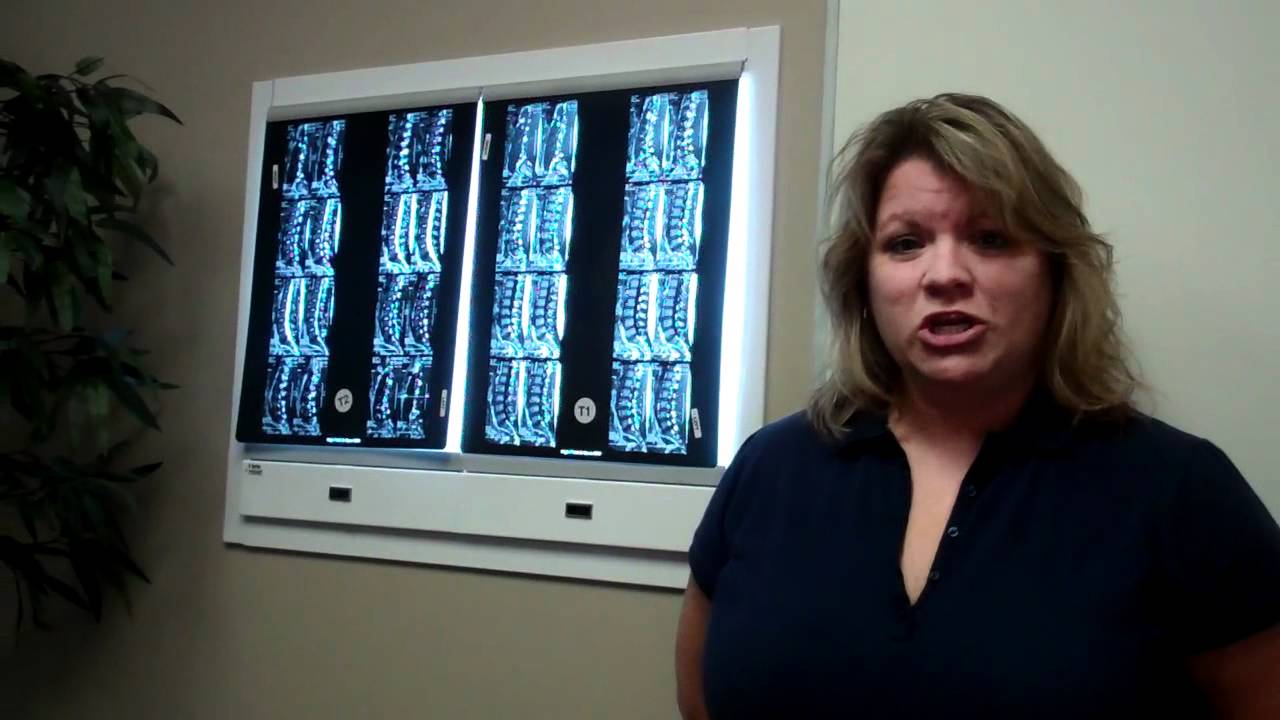 Migraine Testimonial from Carla Jones - YouTube
