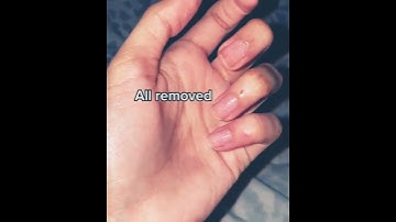 remove acrylic nails at home in 5mins