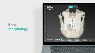 ClearCorrect CBCT Visualization