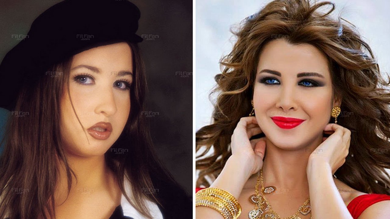 لن تصدق شكل النجوم العرب قبل وبعد الشهرة وعمليات التجميل جديد 2014 Youtube