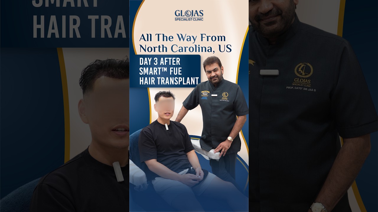 Our Doctors 15 Day 3 after SMART™ FUE! ✨ #hairtransplantmalaysia