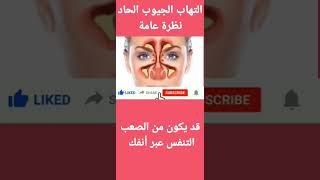 التهاب الجيوب الحادنظرة عامة