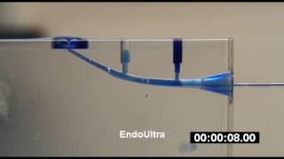 EndoUltra® Canal Block