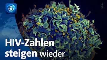 Wie viele Aids Kranke in Deutschland 2022?