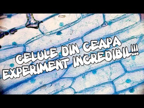 CELULE DIN CEAPA!!! CUM SA EXTRAGI CELULELE DIN CEAPA!? (BIOLOGIE) - #CuDragDeStiinta