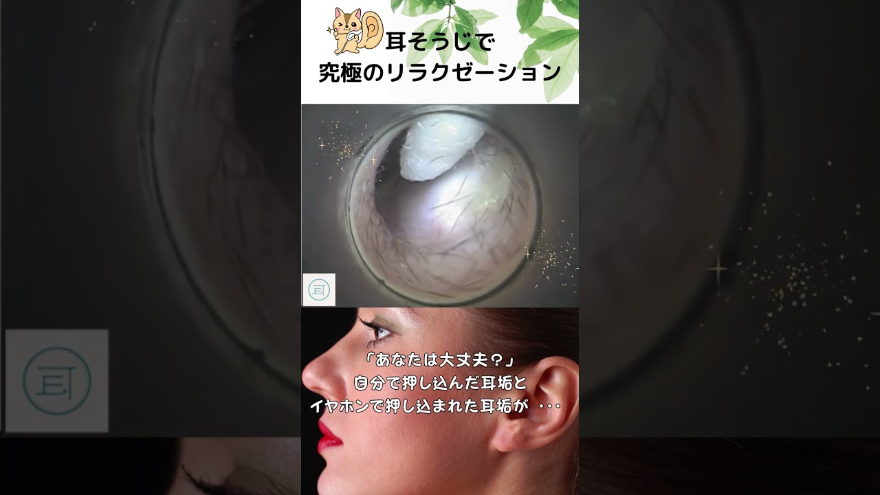 「あなたは大丈夫?」自分で押し込んだ耳垢とイヤホンで押し込まれた耳垢が・・・ #イヤーエステ #耳掃除 #eariss #イヤーエステ #耳掃除 サロン#耳かき動画