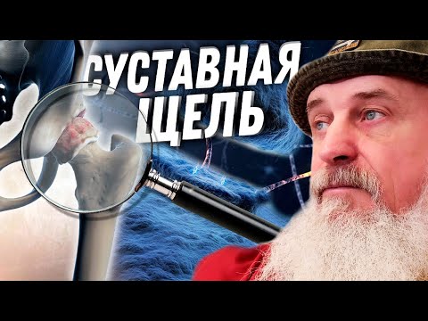 Что такое СУСТАВНАЯ ЩЕЛЬ??? Коксартроз - О САМОМ ГРАВНОМ | Тренер Хапаев