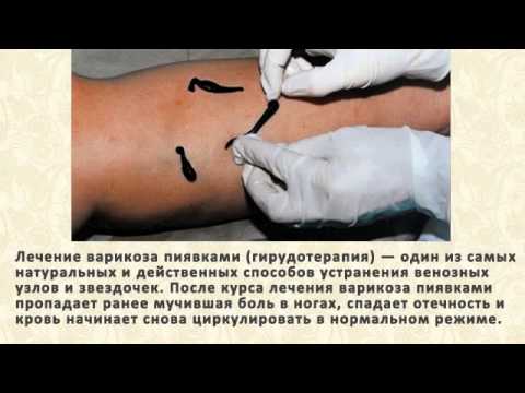 Венами называют сосуды по которым течет кровь