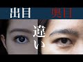 出目と奥目、正面からだとさほど違わないのに横から見ると露骨に違う〜涙袋形成、二重整形