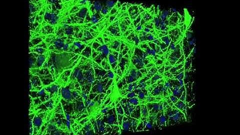 Mouse Cortex Layer 5B
