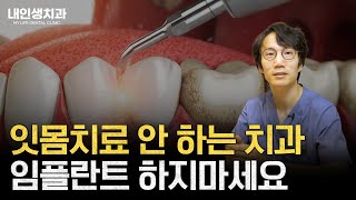 잇몸치료 안 하는 치과 임플란트 하지마세요