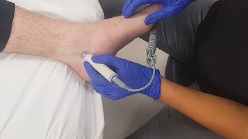 Podiatrists Amy and Jacob each perform a Tibial Block