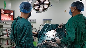 PHẪU THUẬT CẮT TÚI MẬT NỘI SOI TẠI BỆNH VIỆN ĐA KHOA QUANG KHỞI