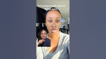 Woman’s eye color after color change surgery is different than what she paid for