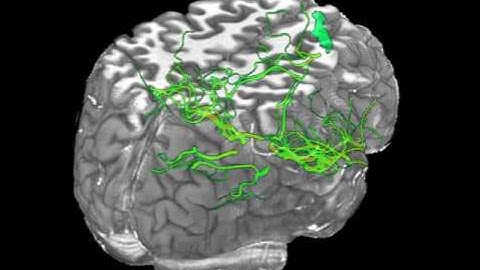 High resolution MRI dataset