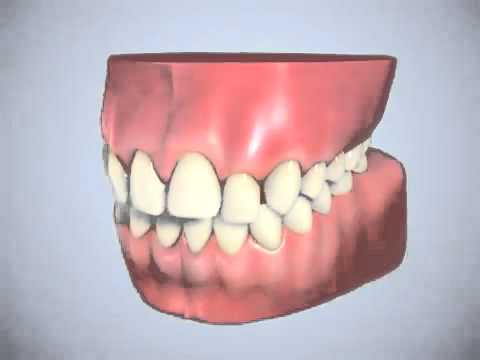 dentist-|-braces-expert-singapore-|-singapore-dental-clinic-|-teeth-whitening-|-video-for-rent
