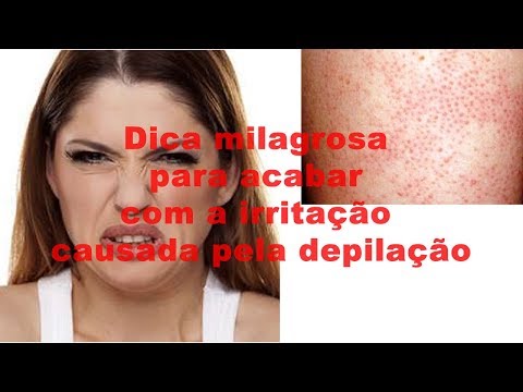 Vídeo: Como Remover A Irritação