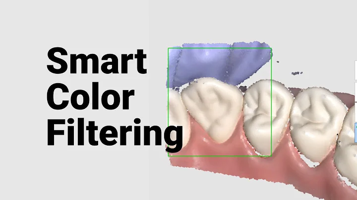 Medit i700 | Better for Patients, Easier for Dentists | Smart Software | Smart Color Filtering