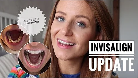 INVISALIGN BRACES UPDATE | INVISALIGN GOT IT WRONG!