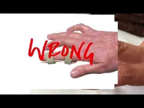 Video: Hur man behandlar Mallet -finger med en skena: 10 steg (med bilder)