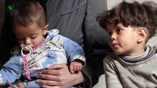أم باسل أمٌ لأربعة أطفال يعانون من سوء التغذية بظل ظروف الحصار في الغوطة_الشرقية