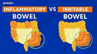 जानें बीमारी जो IBS नहीं है | Coeliac (Celiac) Disease & Lactose Intolerance | Practo