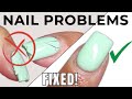 How to Fix Common Gel Nail Problems at Home
