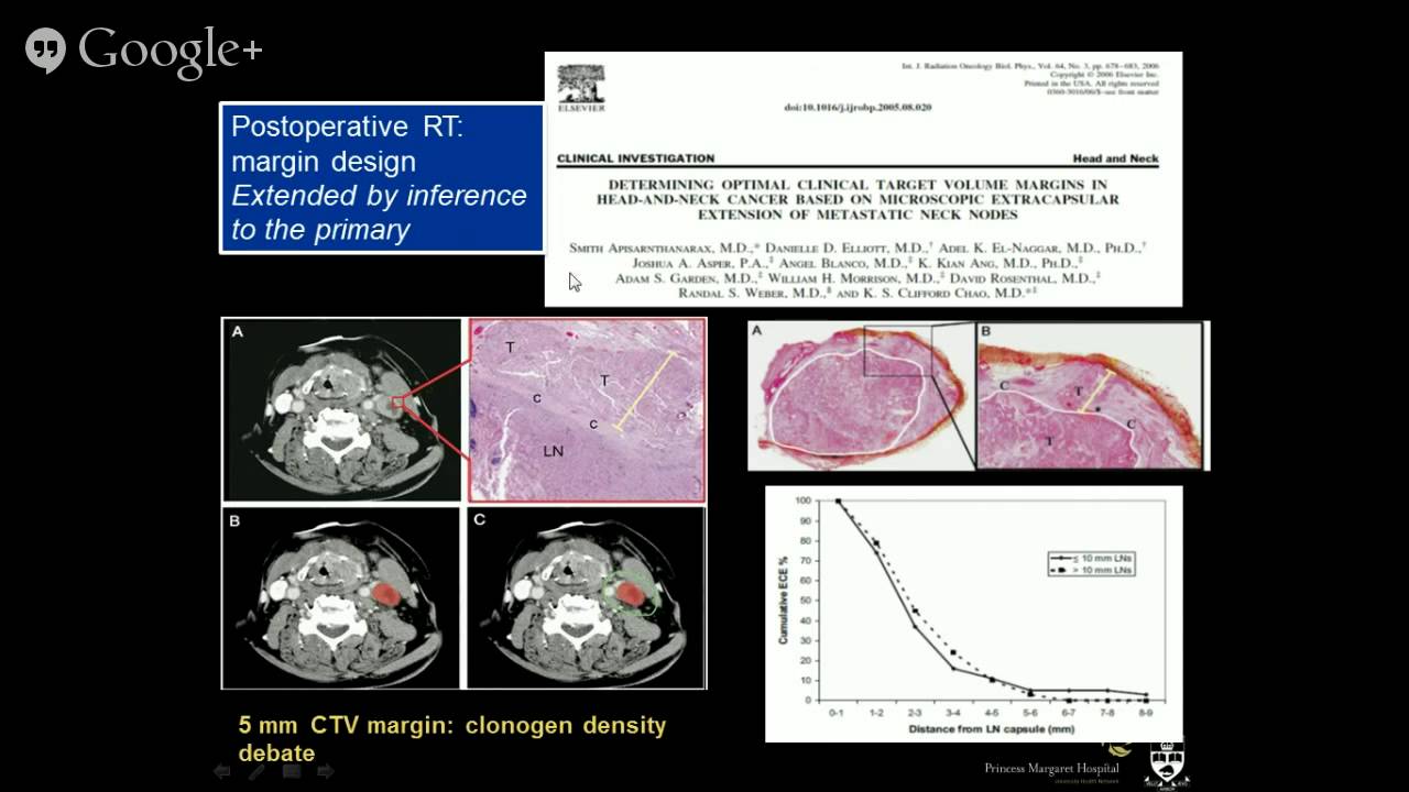 General Principles of Head & Neck Cancer Management