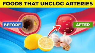 10 AMAZING Foods that UNCLOG Arteries...
