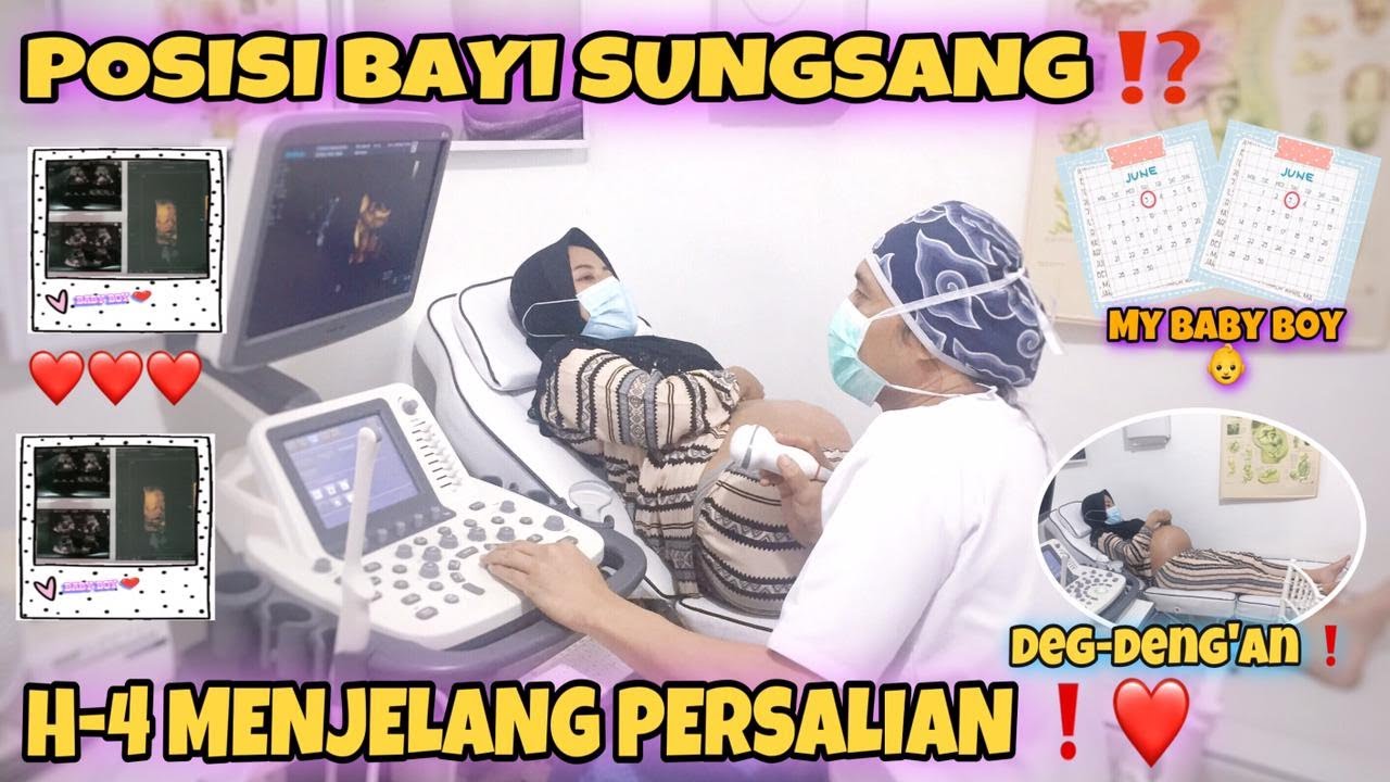USG 4D KANDUNGAN 37 MINGGU MENJELANG PERSALINAN, POSISI JANIN SUNGSANG ⁉️
