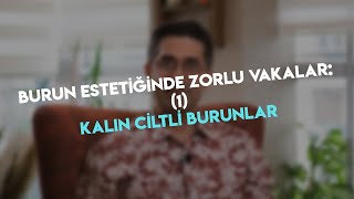 Burun Estetiğinde Zorlu Vakalar: (1) Kalın Ciltli Burunlar