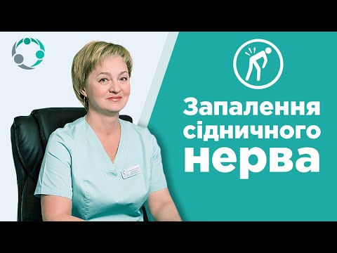 👩 Запалення сідничного нерва: що таке ішіас, симптоми, причини, ознаки