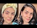 DIY Mask for Open Pores, Clear, Glowing skin! Home remedy 100% works!