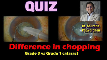 306 Quiz: verschil in hakselcataract graad 1 en graad 3 Dr. Sourabh Patwardhan