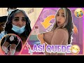 ASÍ QUEDE DESPUÉS DE LA CIRUGÍA 🤤 **RECUPERACION** Queen Buenrostro