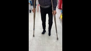 소아마비보조기 티솔루션 반자동보조기 착용 전,후 입니다^^