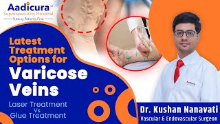 All You Need To Know About Varicose Veins Dr Kushan Nanavati Aadicura Superspeciality Hospital
