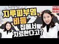 (*Eng) 지긋지긋한 지루피부염, 비듬 없애는 법 - 피부과전문의 [닥터필러]